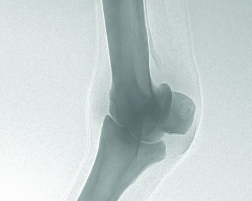 Bone image of an equine knee joint.